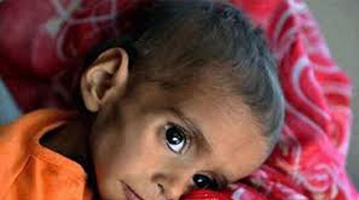 Two minors succumb to malnutrition in Mithi 