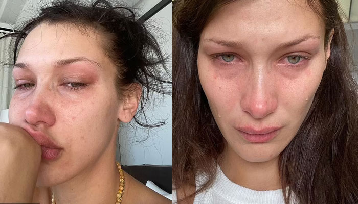 Bella Hadid reveals her agony with tearful selfies