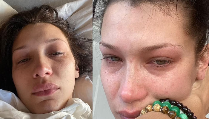 Bella Hadid reveals her agony with tearful selfies