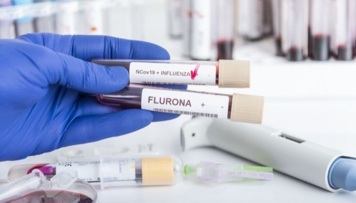Flurona, a term coined by experts to describe being infected with both COVID-19 and the flu at the same time.&nbsp;&mdash; Stock/ File.