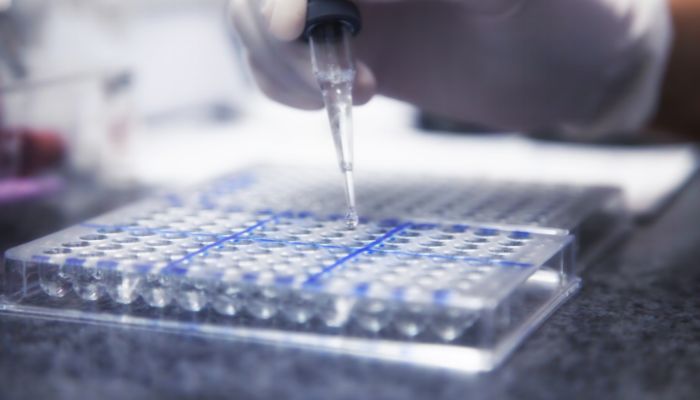 Rapid test for HIV in laboratory &mdash; Canva/file
