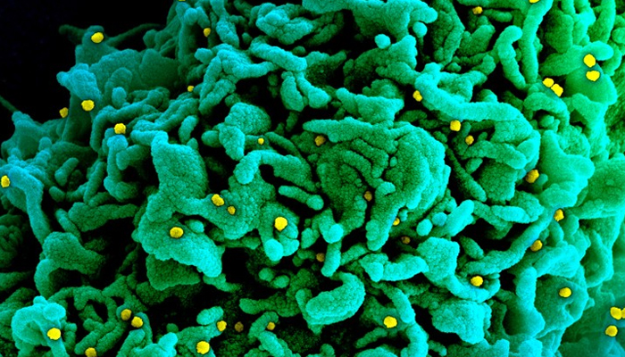 A cell infected with particles (yellow; artificially coloured) of the SARS-CoV-2 variant called B.1.1.7, which is more easily transmitted than other versions of the virus.&mdash;National Institutes of Health