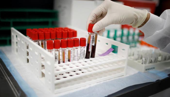 A health worker takes test tubes with plasma and blood samples after a separation process in a centrifuge during a coronavirus disease (COVID-19) vaccination study at the Research Centers of America, in Hollywood, Florida, US, September 24, 2020. &mdash; Reuters/File