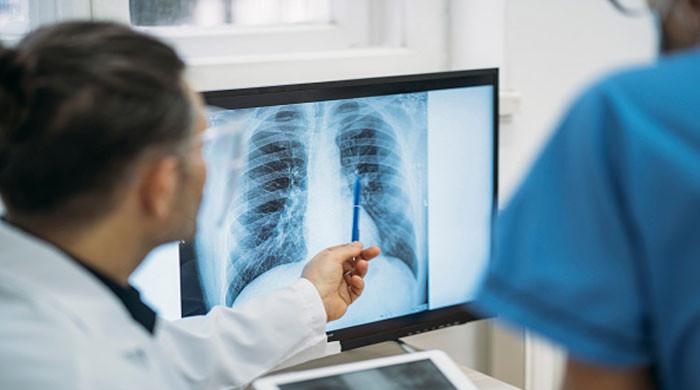 Pakistan may face shortage of x-ray films, warns importer