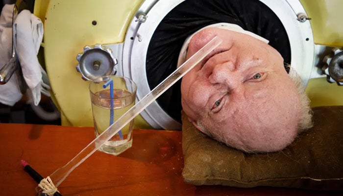 Paul Alexander known as polio Paul in a medical machine. — Guinness World Record