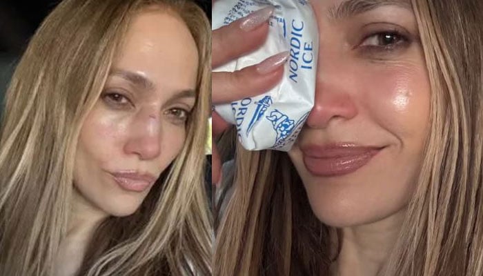 Jennifer Lopez reveals she got stitches following stage mishap