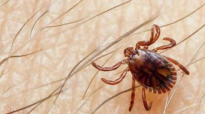 Two doctors at Karachi's Jinnah Hospital exhibit suspected symptoms of Congo virus