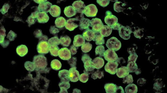 Karachi reports fourth Naegleria death of 2025