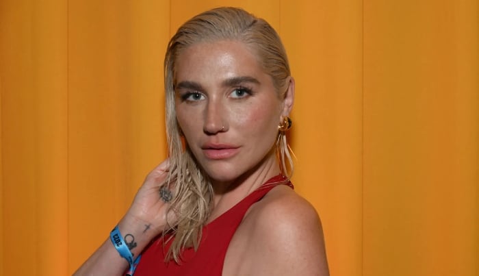 Photo: Kesha talks freedom, joy amid latest music album release