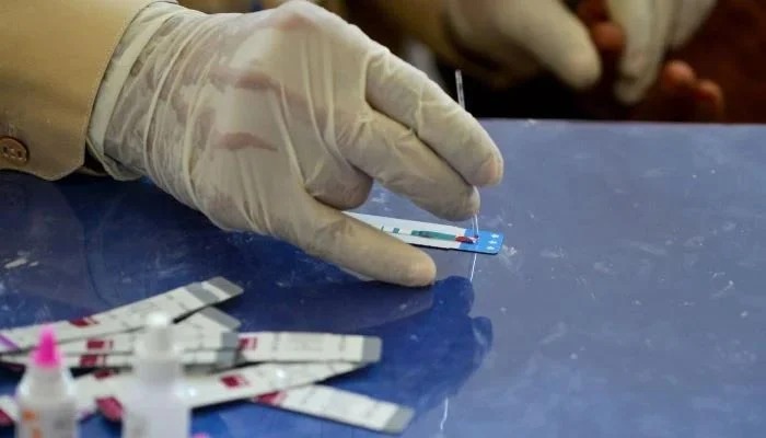 In this image taken on May 8, 2019, a Pakistani doctor examines the blood sample from a patient for a HIV test at a state-run hospital. - AFP