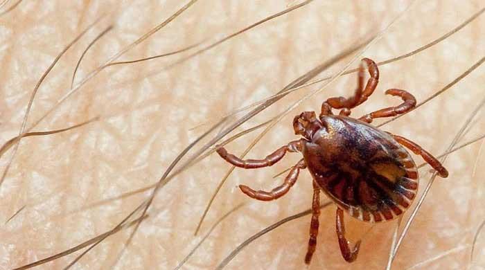 Congo virus toll climbs to 6 in Sindh, with 5 deaths reported from Karachi