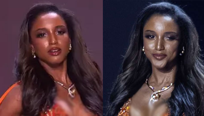 Gabrielle Henry not doing as well as hoped after Miss Universe accident