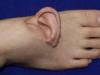 Chinese surgeons attach woman's torn ear to foot after accident