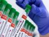 Pakistan registers second mpox-linked death
