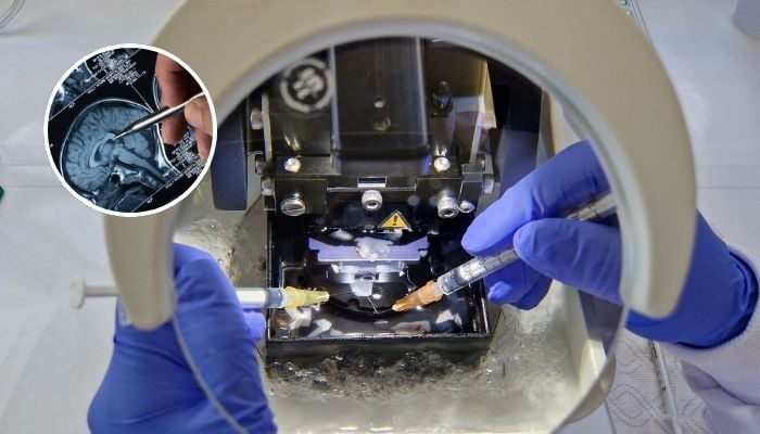 Dead brain tissue ‘reawakened by scientists in stunning medical discovery