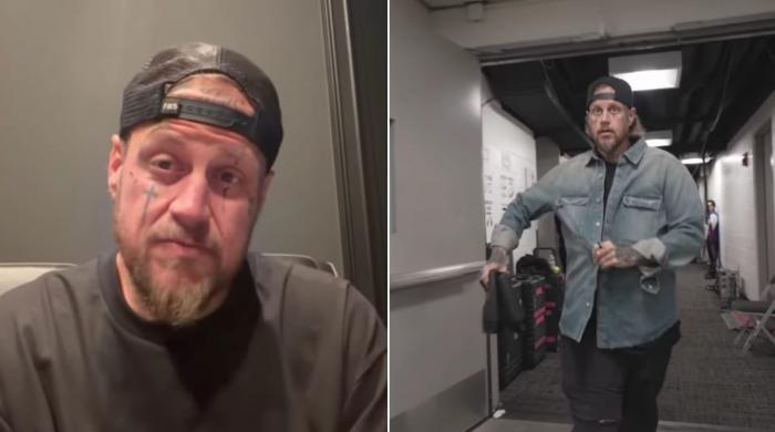 Jelly Roll gets brutally honest about health setback: 'Lost my way'