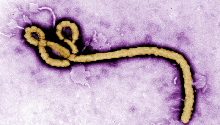 Some of the ultrastructural morphology displayed by an Ebola virus virion is revealed in this undated handout colourised transmission electron micrograph (TEM) obtained by Reuters on August 1, 2014. — Reuters
