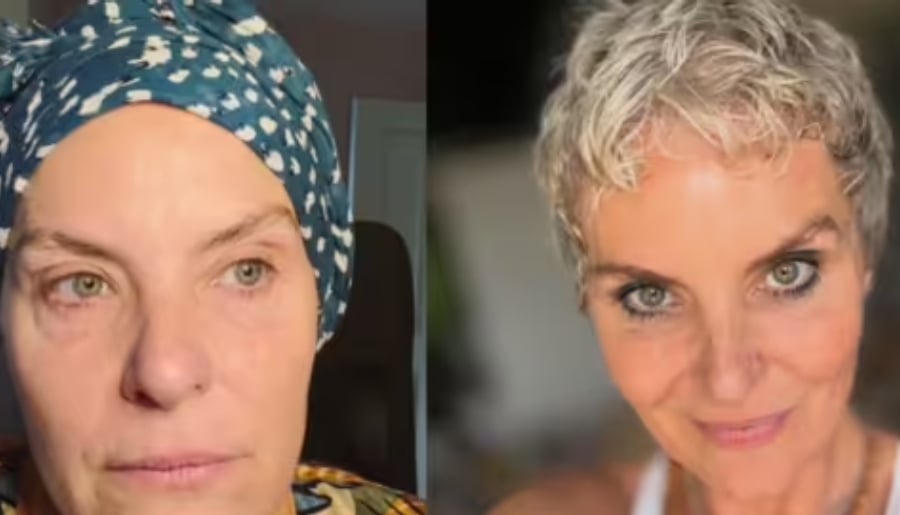 The actress opened up about the impact of her chemotherapy treatment following her breast cancer diagnosis
