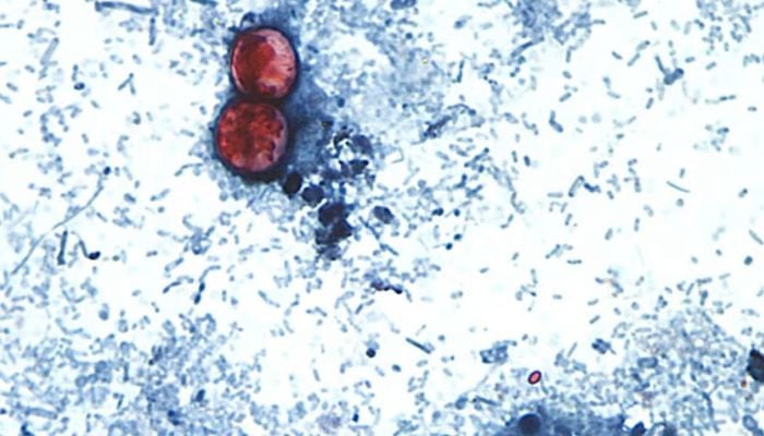Diarrhea-causing parasite linked to raw produce spreads across multiple states
