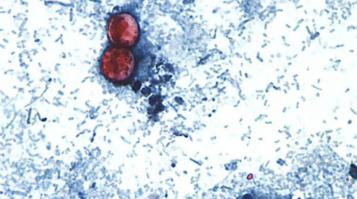 Diarrhea-causing parasite linked to raw produce spreads across multiple states
