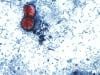 Diarrhea-causing parasite linked to raw produce spreads across multiple states