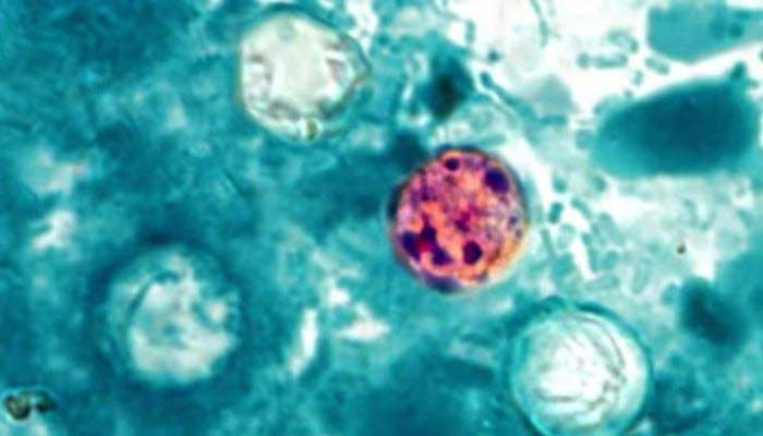 Explosive diarrhea parasite hits 18 states as health officials scramble to find source