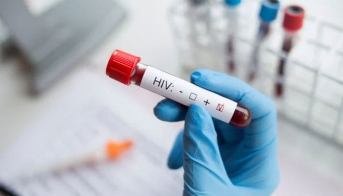 This representational image shows a person holding an HIV test tube. — Reuters/File