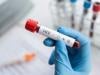 Karachi's Valika Hospital HIV tally reaches 80 as two more children test positive