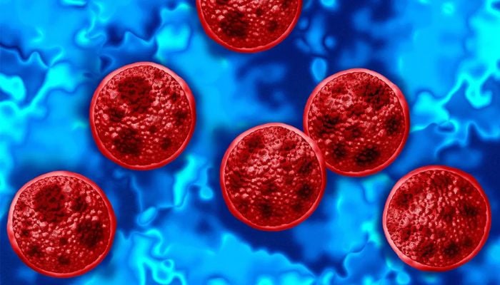 List of foods to avoid cyclosporiasis: Here are items linked to parasite outbreaks