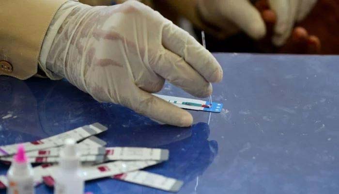 A Pakistani doctor examines the blood sample from a patient for a HIV test at a state-run hospital. — AFP