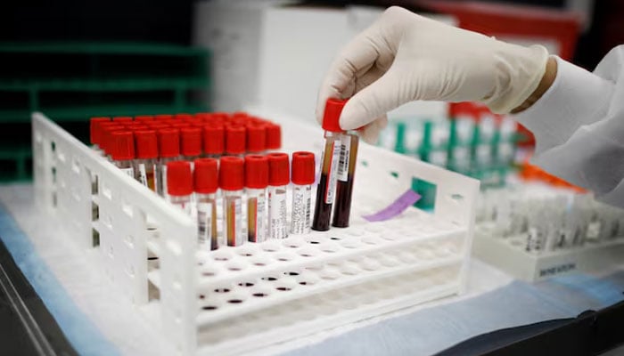 A health worker takes test tubes with plasma and blood samples in Hollywood, Florida, US, September 24, 2020. — Reuters