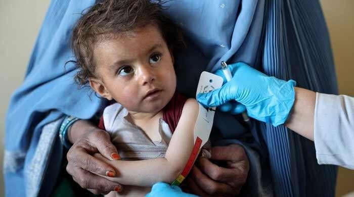 One million Afghan children suffering 'life-threatening' malnutrition: UN