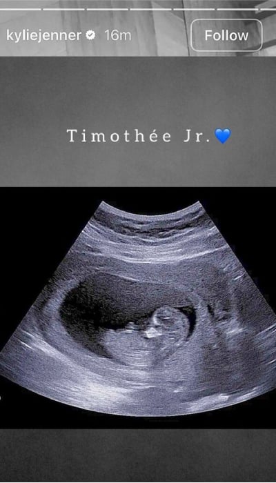 Kylie Jenner addresses rumours shes pregnant with Timothee Chalamets child