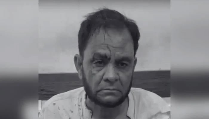 KU Department of Islamic Learning Chairman Arif Saqi is seen after being subjected to torture by a hotel owner’s son and his guards on September 8, 2026. — Geo News/screengrab