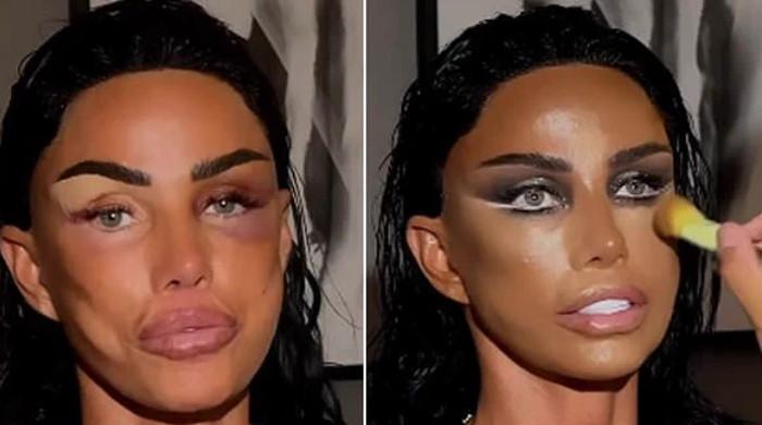 Katie Price covers bruises with glamorous makeover ahead of NTAs appearance