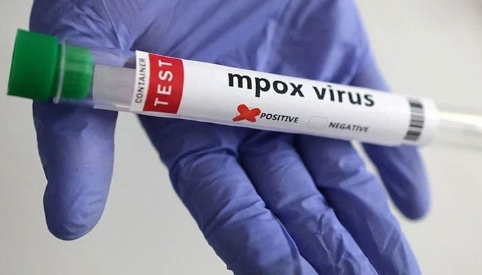 A test tube labelled Mpox virus positive is held in this illustration, taken on August 20, 2024. —Reuters